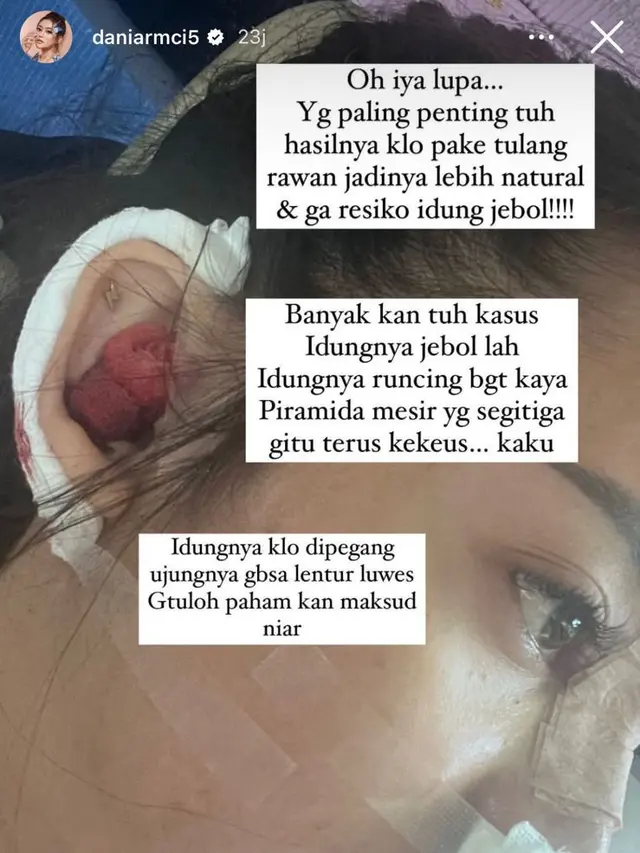 6 Potret Daniar Masterchef Usai Operasi Hidung, Jadi Sorotan