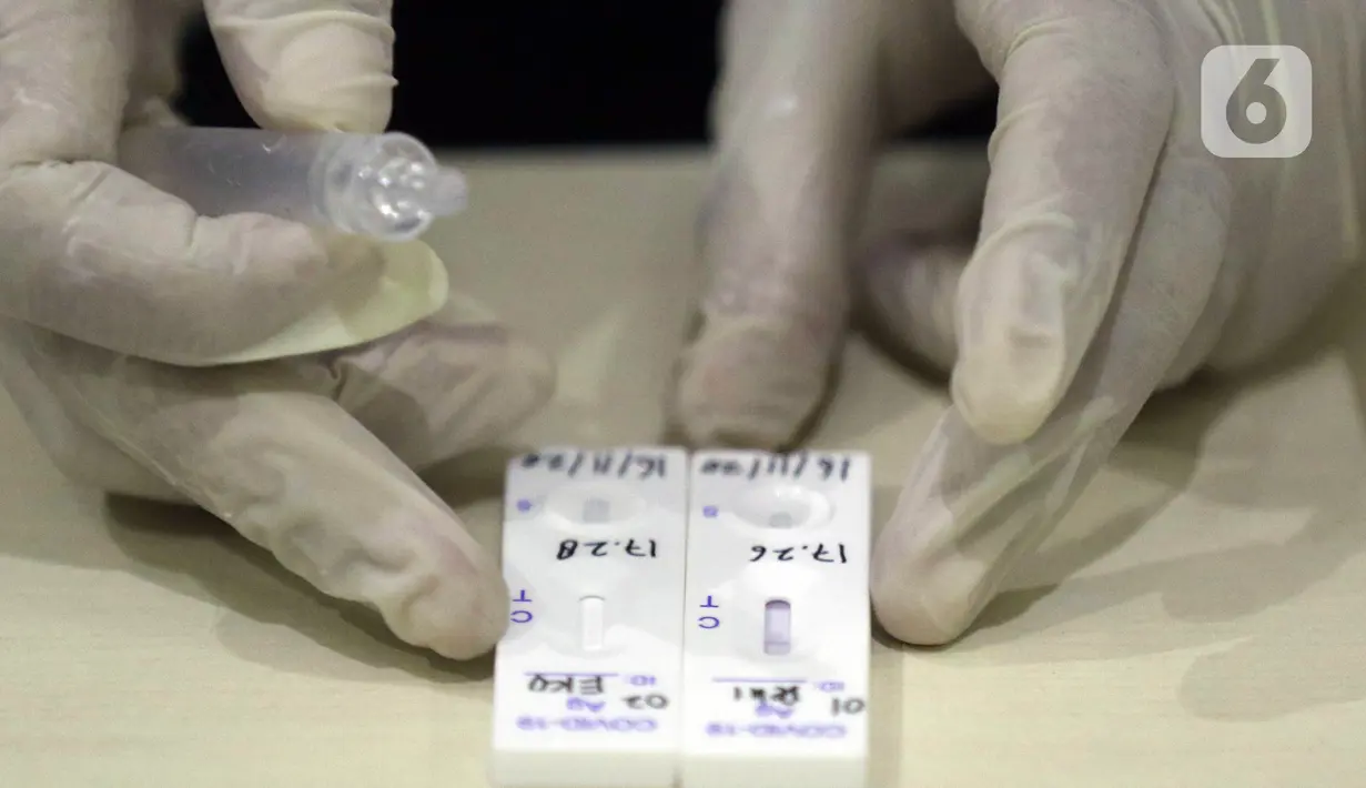 Petugas medis mengecek hasil rapid test antigen di ruang wartawan Gedung KPK, Jakarta, Senin (16/11/2020). Sejak diumumkan pertama kali pada Maret 2020 hingga Senin (16/11) kasus konfirmasi positif Covid-19 di Indonesia secara keseluruhan mencapai 470.648 kasus. (Liputan6.com/Helmi Fithriansyah)