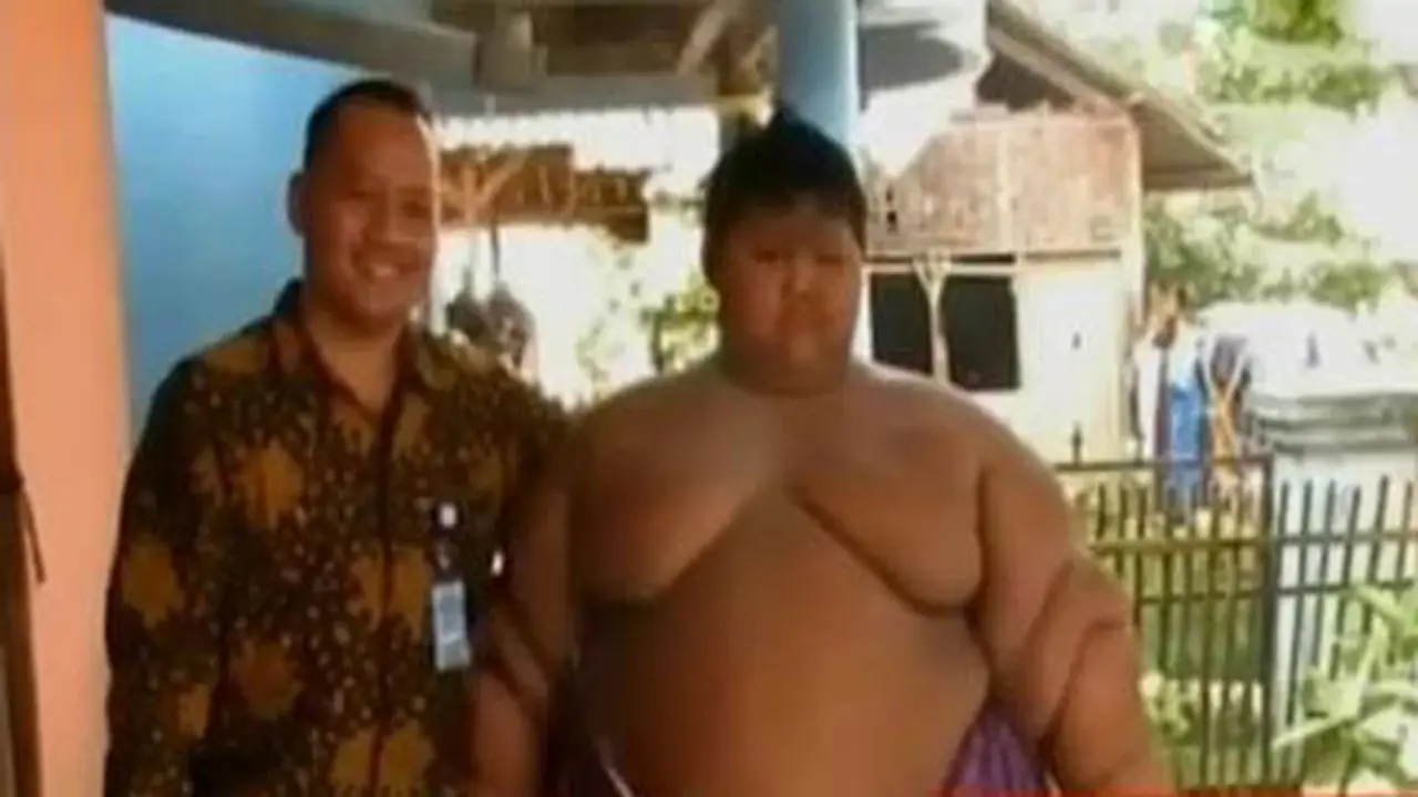 VIDEO: Bocah Obesitas Ini Ternyata Bertubuh Normal Saat Kecil