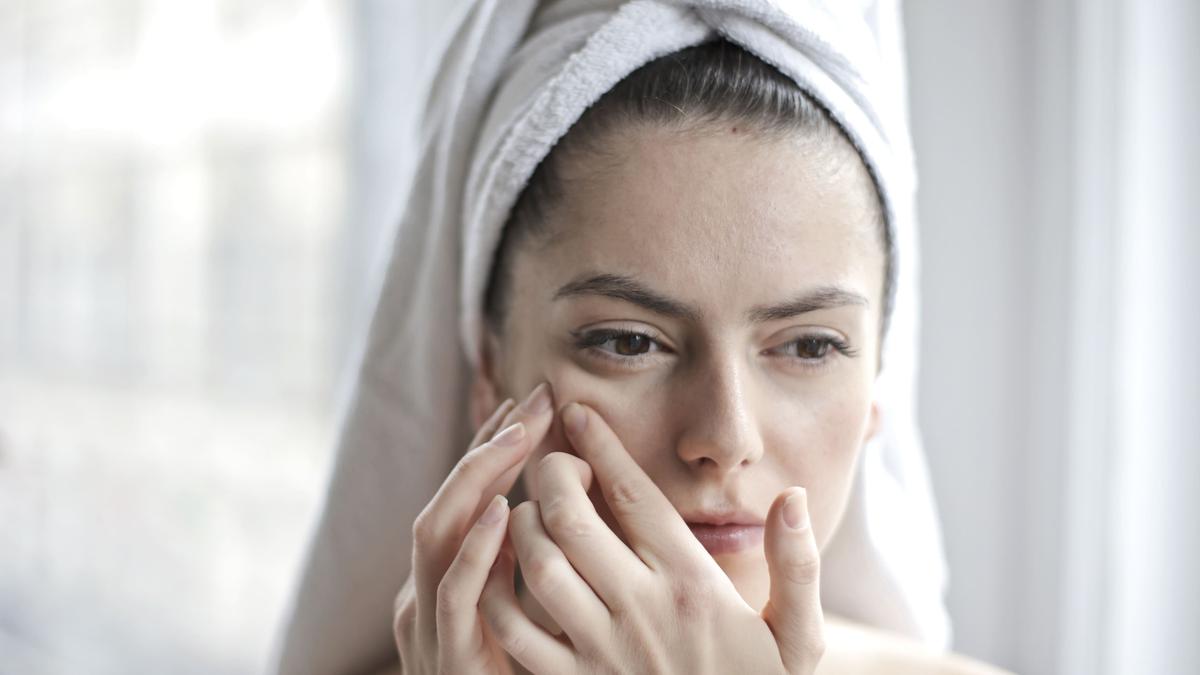 Kulit Lagi Stres? Begini Cara Mengatasinya Tanpa Bikin Jerawat Makin Parah
