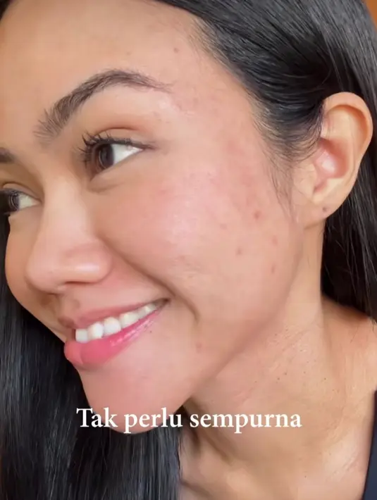 Selain ketiak, lewat videonya Yura juga menunjukkan ketidaksempurnaanya yang lain. Ya, Yura menunjukkan kulit wajahnya yang tak mulus, di mana ada jerawat dan bertekstur. [Foto: Instagram/yurayunita]