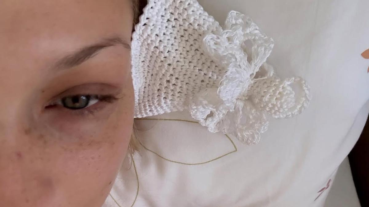 Bella Hadid Unggah Foto Lengan Diinfus, Kembali Diserang Lyme Disease?