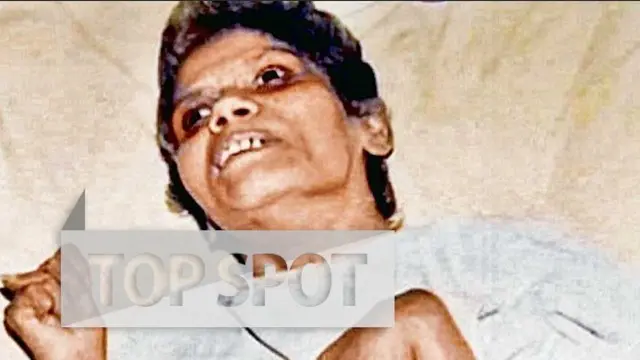 6 Kasus Pemerkosaan di Dunia yang Paling Sadis dan Memilukan