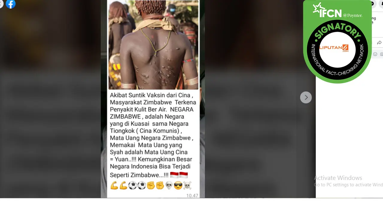 Hoaks Masyarakat Zimbabwe Kena Penyakit Kulit usai Divaksin Buatan China