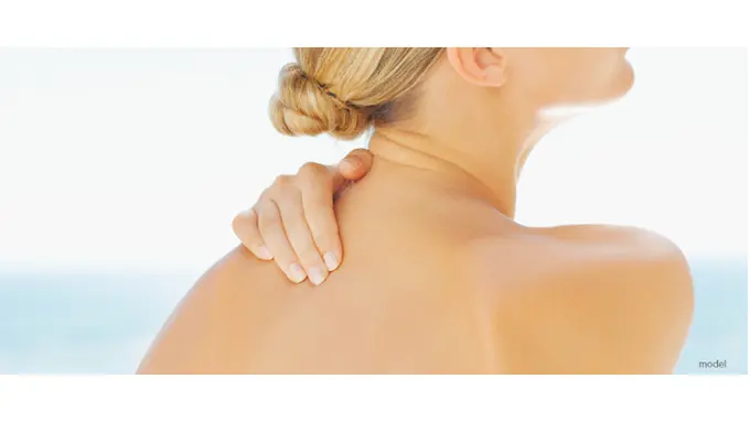 Kiat Mencegah Munculnya Jerawat Pada Punggung