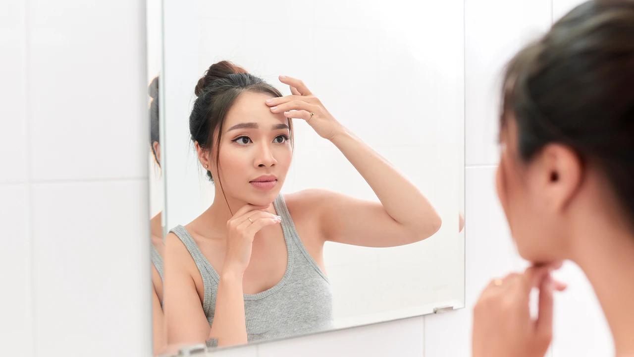 Mirip tapi Tak Sama, Kenali Perbedaan PIE vs PIH Agar Bekas Jerawat Cepat Memudar