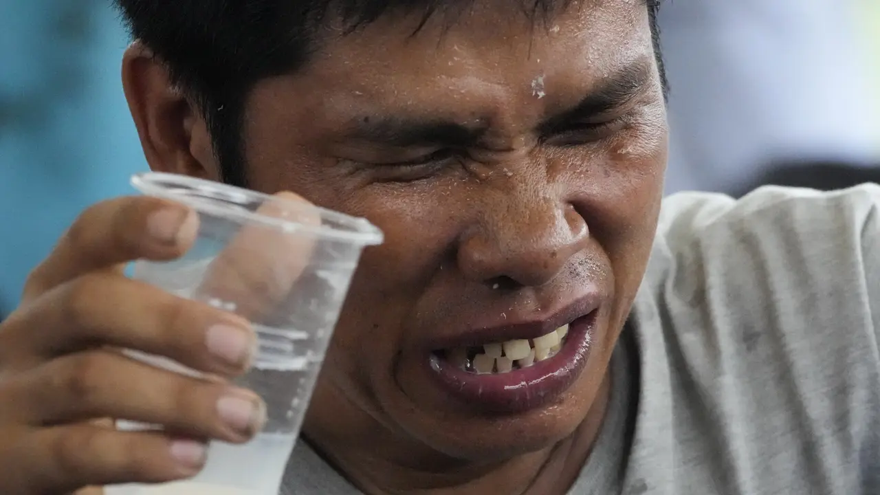 Ancaman Pedas dan Asam bagi Lambung Milenial dan Gen Z, Berpotensi Meledak dan Harus Segera Dicegah (AP Photo/Aaron Favila)