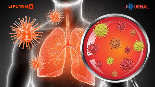 Pneumonia Adalah Peradangan pada Parenkim Paru-paru, Kenali Tanda-tandanya