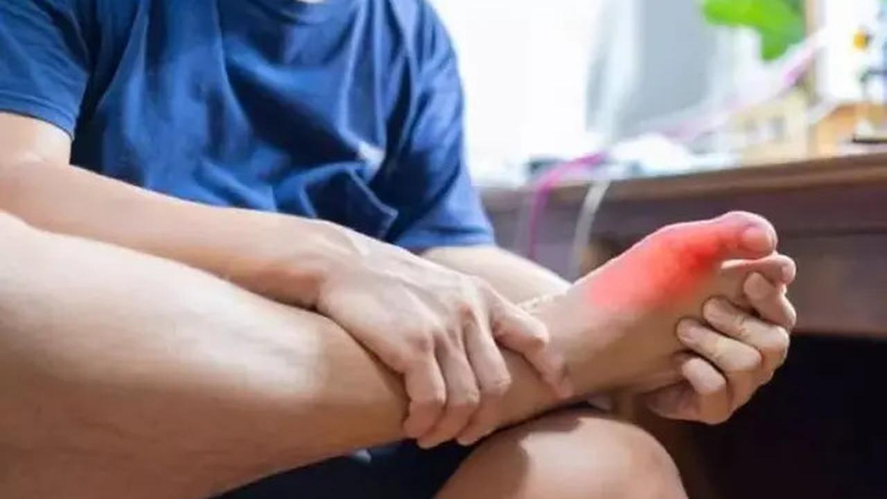 Cara Mengobati Asam Urat di Usia Muda, Wajib Jaga Pola Makan dan Olahraga