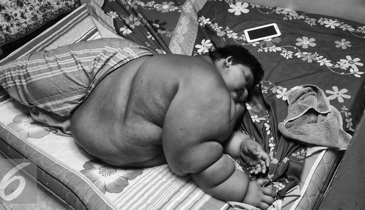 Ariya tertidur pulas di kamarnya di Karawang, Jawa Barat. Meski sudah tidak mampu pergi ke sekolah, Ariya anak yang pandai, terbukti dari prestasinya selama menjadi murid di SDN Cipurwasari 1. (Liputan6.com/Gempur M Surya)