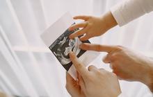 Viral Bayi Dalam Kandungan Wanita ini Tiba-Tiba Hilang saat Mau Lahiran Padahal Rutin USG, Dokter Sampai Bingung