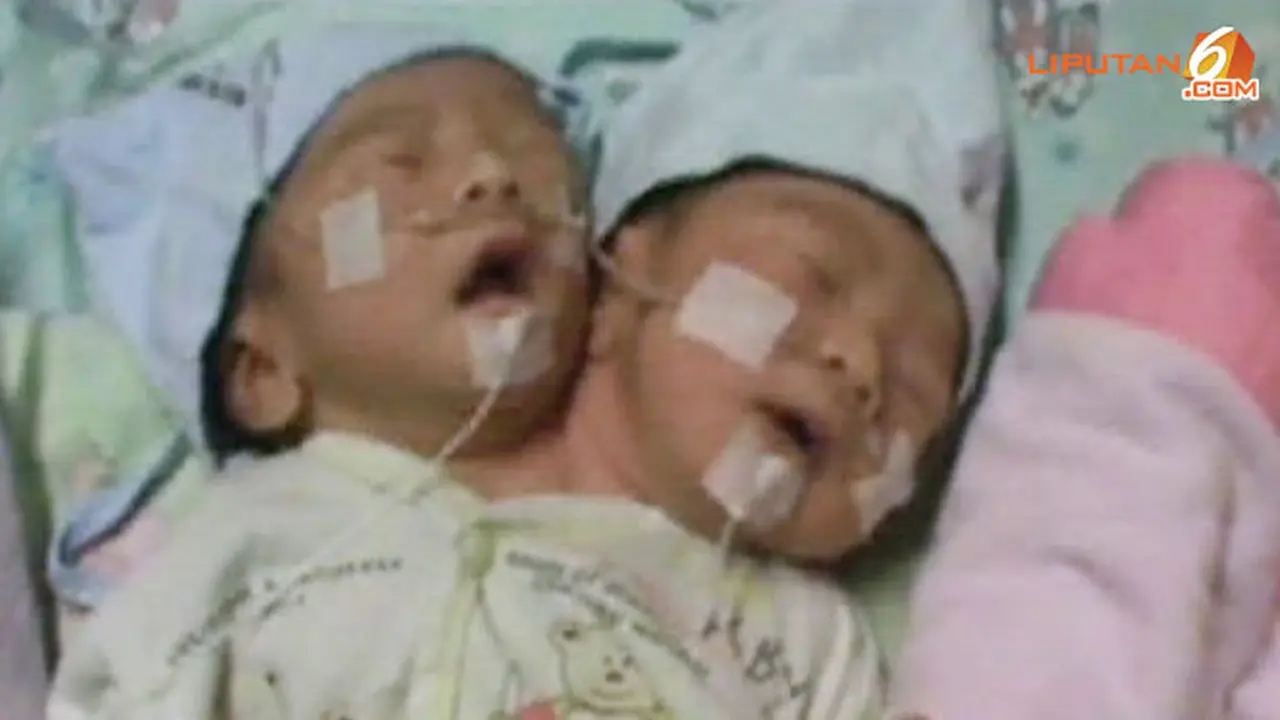 bayi-kepala-130628c.jpg
