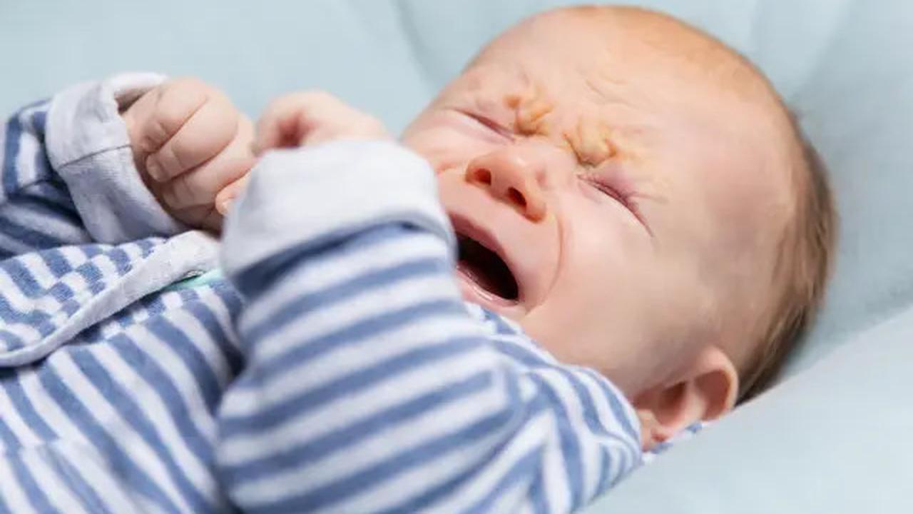7 Tanda Alergi pada Bayi dan Cara Efektif Mengatasinya, Jangan Sampai Terabaikan!