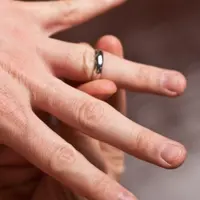 Jangan panik saat cincin susah dikeluarkan dari jari. Begini cara amannya.