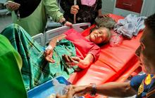 Alami Luka Bakar, Nenek di Jambi Ditolak RS Meski Punya KIS dan BPJS