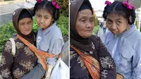 Nenek berusia 74 tahun asal Bogor ini rela menggendong sang cucu dari kediamannya di Bogor hingga ke RS Cipto Mangunkusumo, Jakarta.