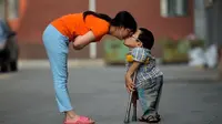 Pasangan difabel ini membuktikan cinta sejati tak mengenal batasan fisik (Foto: Womenofchina)