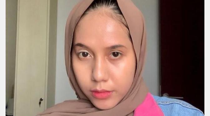 Potret Nadya Arifta, Perempuan yang Dikabarkan Dekat Dengan Kaesang Pangarep. (Sumber: Instagram/nadrifta)