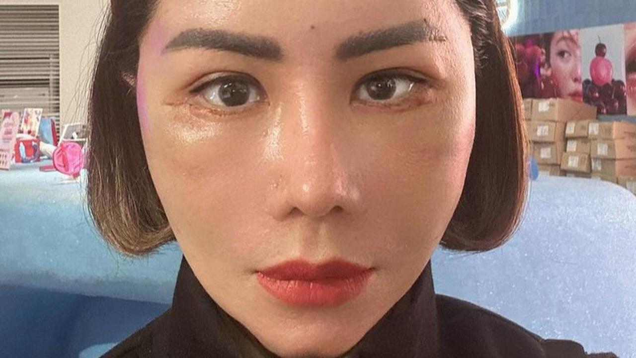 Potret Femmy Permatasari Kembali Jalani Oplas di Korea Selatan, Wajah Bengkak Karena Masih Proses Recovery