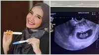 Zaskia Sungkar ditemani Irwansyah cek kandungan pertama kali setelah positif hamil. (Sumber: Instagram/@zaskiasungkar15/YouTube/The Sungkars Family)