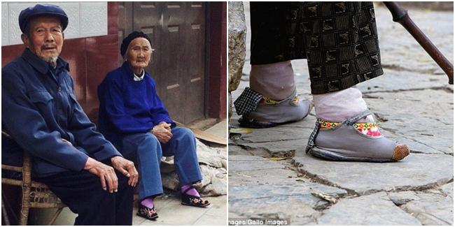 Wang Huiyuan dulu harus menjalani pembebatan kaki sebagai bagian dari tradisi. | Foto: copyright dailymail.co.uk