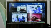 Kolaborasi Telkomsel dan Urological Association of Asia (UAA), dengan dukungan dari Kementerian Kesehatan RI dan Kementerian Komunikasi dan Informatika, berhasil menghadirkan solusi Robotic Telesurgery yang didukung 5G Telkomsel. (Foto: Telkomsel).