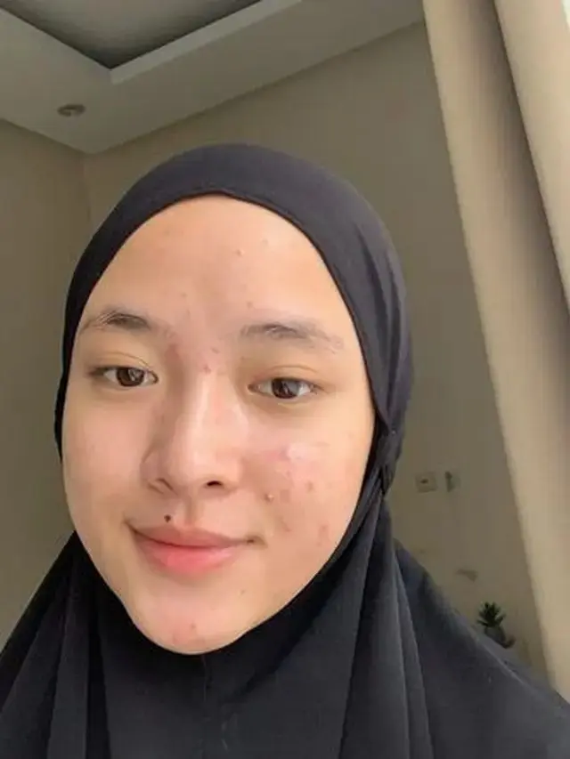 Nissa Sabyan Tanpa Makeup