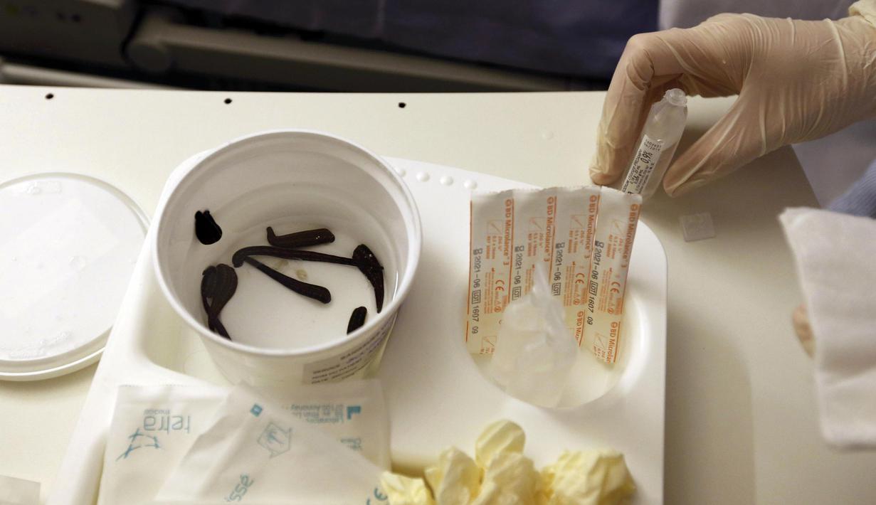 Dokter menyiapkan sejumlah lintah untuk terapi, Prancis, (23/11).Liur lintah  Ini mampu mengencerkan darah dan meningkatkan peredaran darah di daerah luka. (REUTERS / Regis Duvignau)