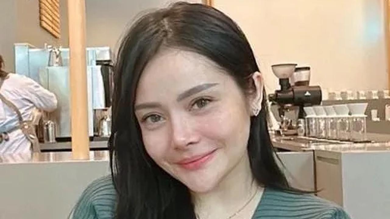 Potret Terbaru Mawar AFI Usai Jalani Oplas Hidung di Korea Selatan, Makin Cantik Bak ABG 17 Tahun