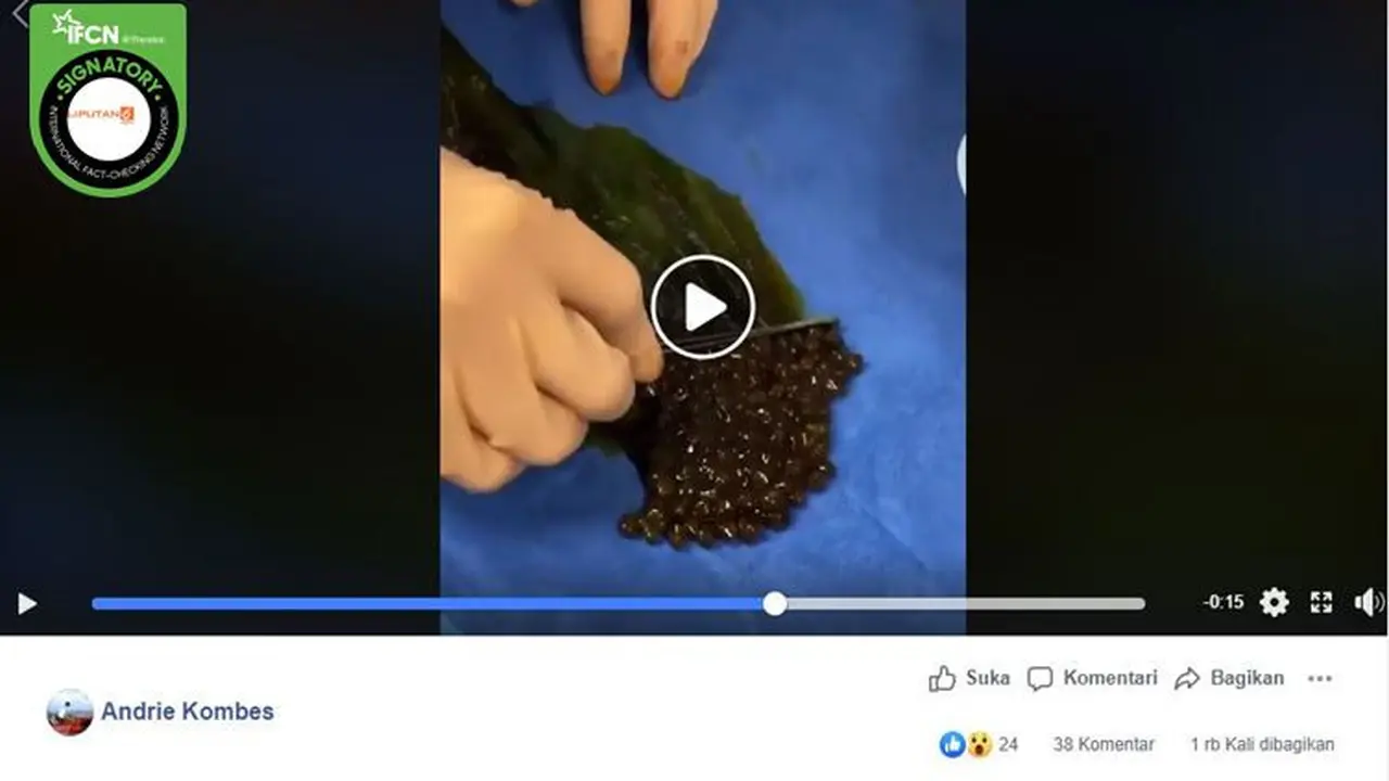 [Cek Fakta] Gambar Tangkapan Layar Video Operasi Kantong Empedu