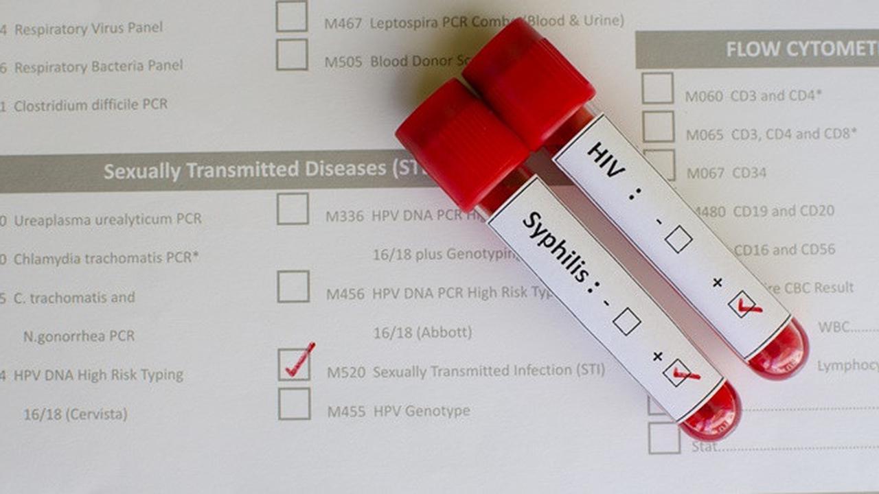 Penyakit Menular Seksual