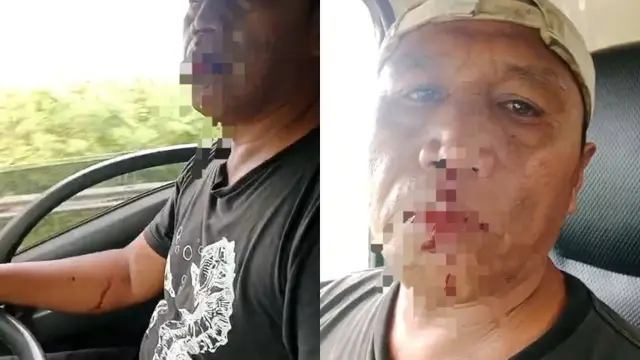 Tangkapan layar sopir truk di Lampung menjadi korban pemalakan dan penganiayaan seorang preman hingga mengalami patah hidung.