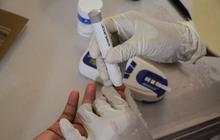 Dokter Paparkan Pentingnya Terapi Insulin Diabetes: Kapan Pasien Membutuhkannya?