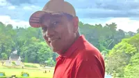 [Kolom Pakar] Prof Tjandra Yoga Aditama: Enam Pesan Kunci Jelang Hari TB Sedunia