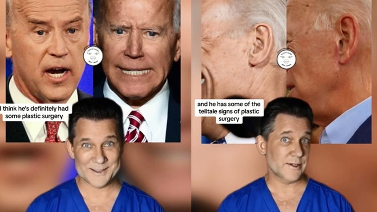 Ahli Bedah Plastik Klaim Joe Biden Habiskan Rp1,5 Miliar untuk Pengencangan Wajah dan Alis