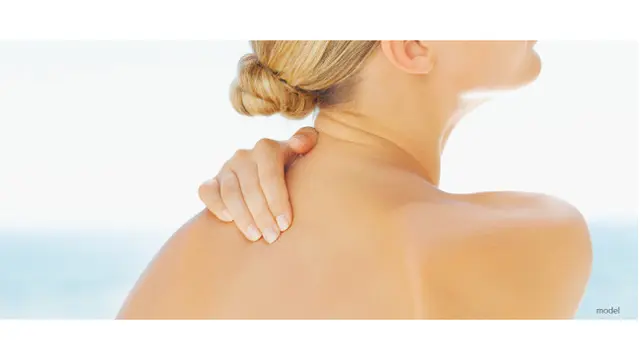 Kiat Mencegah Munculnya Jerawat Pada Punggung