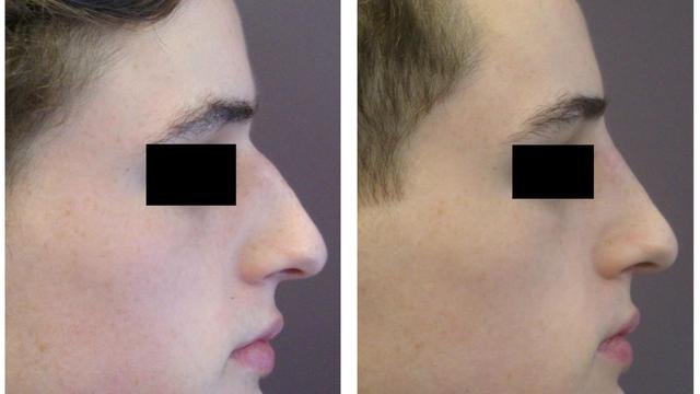 [Bintang] Berminat Tanam Benang? Coba Lihat Dulu Video yang Diunggah Oleh Dr Tompi Ini, Bikin Ngilu