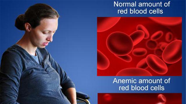 Ubat tambah darah untuk ibu hamil
