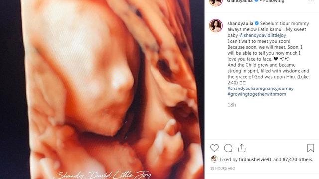 Shandy Aulia (Foto: Instagram/@shandyaulia)