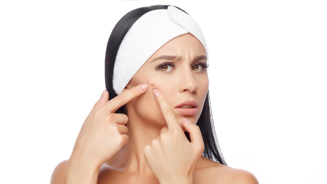 ilustrasi obat jerawat/pexels