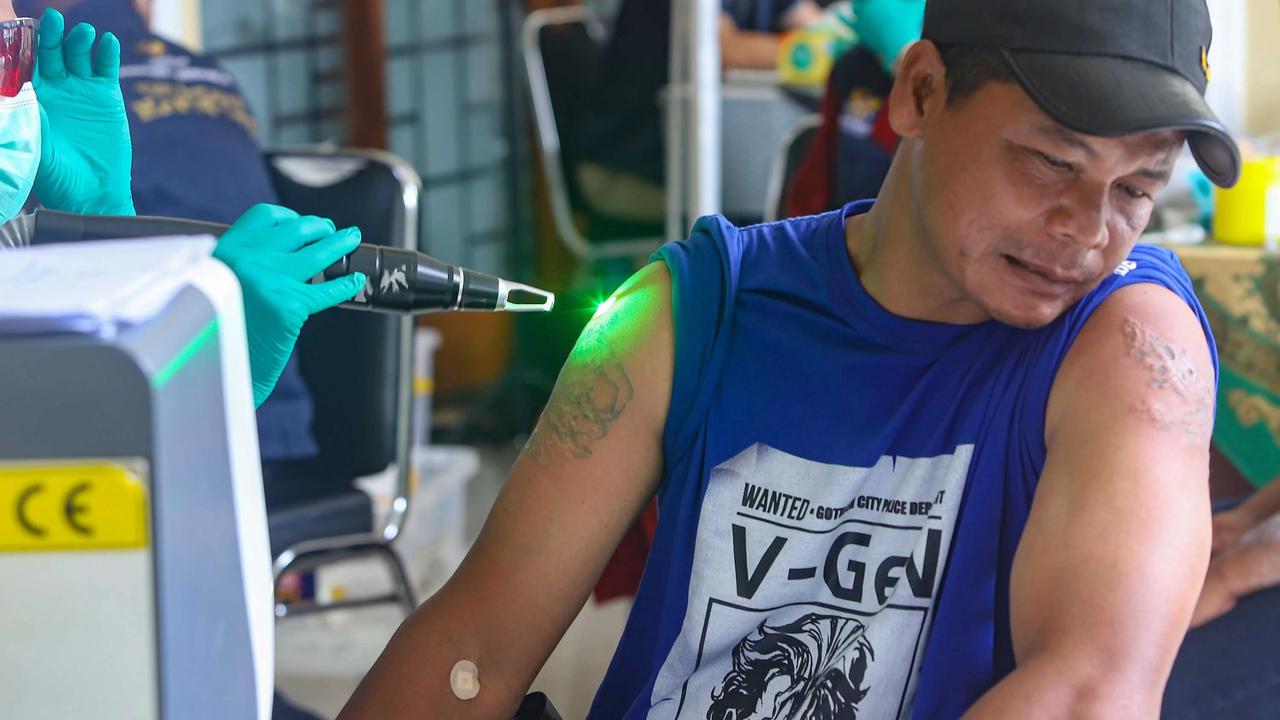 FOTO: Layanan Hapus Tato Gratis Sambut Ramadhan di Jakarta
