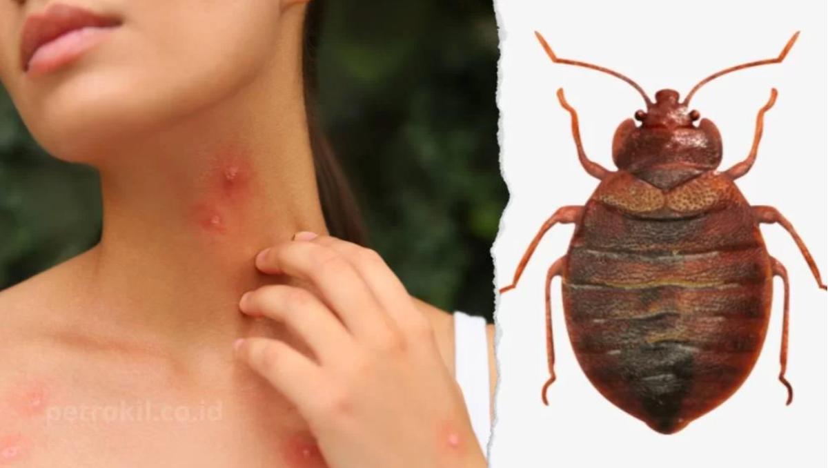 Rahasia Ampuh Menghilangkan Kutu Kasur, Rumah Bebas Gatal dalam Waktu Singkat!