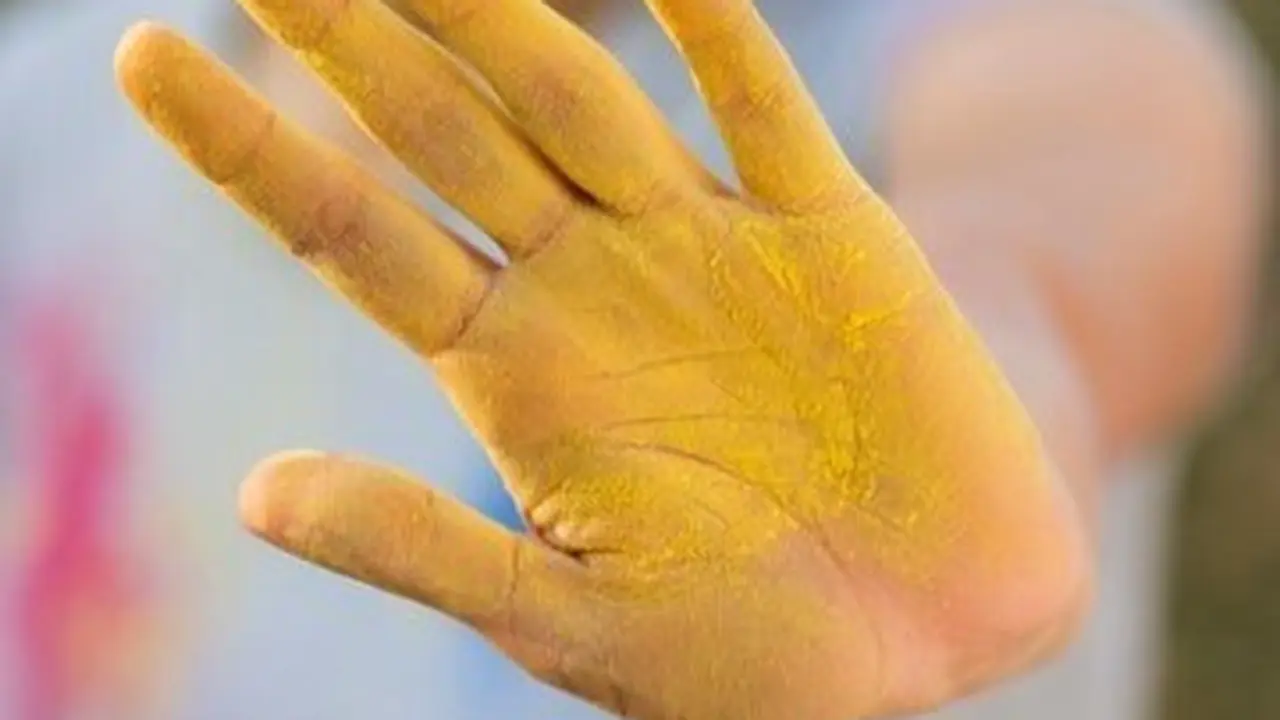 Rahasia Bersihkan Noda Kunyit di Jari, Bahan Ini Ternyata Lebih Efektif dari Baking Soda