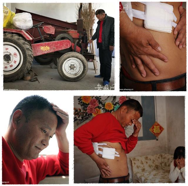 Liu kehilangan ginjal setelah melakukan operasi dada | Photo: Copyright shanghaiist.com