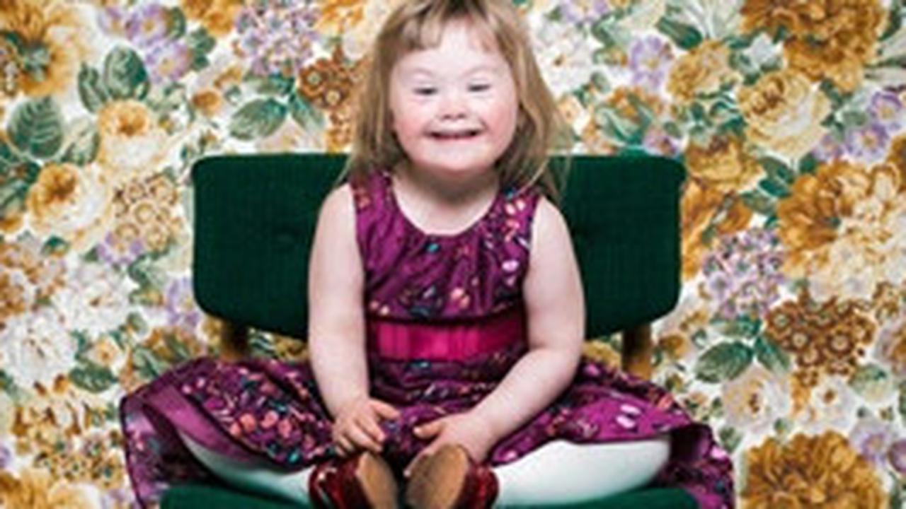 Karakteristik Anak dengan Down Syndrome, Panduan Komprehensif bagi Orangtua