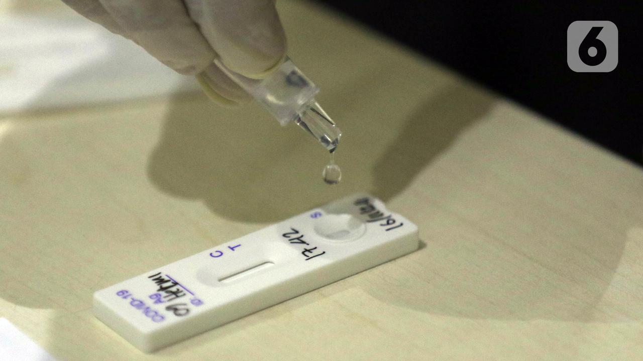 FOTO: Cegah Penyebaran COVID-19, Pewarta Jalani Rapid Test Antigen