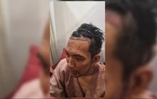 Deretan Artis Tanah Air Jalani Transplantasi Rambut, Terbaru Ada Desta yang Penampilannya Bikin Pangling