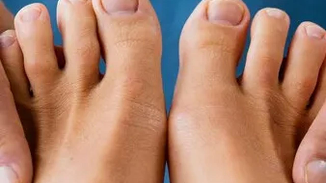Penyebab Umum Bau Kuku Kaki