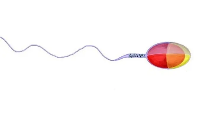 Ketahui Arti dari 4 Jenis Warna Pada Sperma