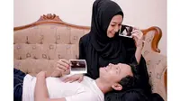 5 Artis yang Umumkan Kehamilan Jelang Ramadan, Terbaru Istri Fedi Nuril (sumber: Instagram.com/fedi_nuril)